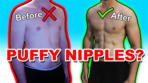 puffy nipples girl|Puffy Nipples and How To Get Rid of Them